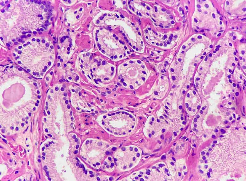  New consortium aims to establish the biggest pathology data to advance artificial intelligence
