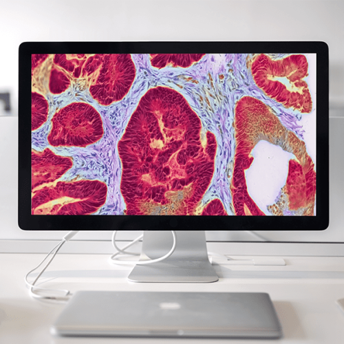 Tribun - AI - Digital Pathology