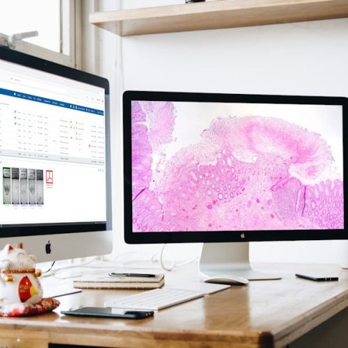 Tribun Digital Pathology - Calopix