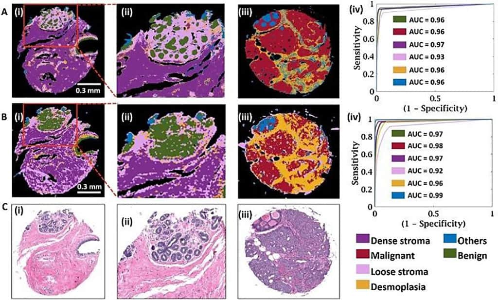 Configuring infrared spectroscopy tools to better detect breast cancer