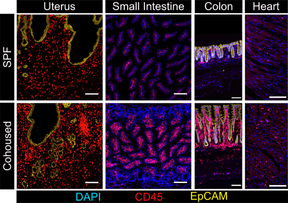  New findings suggest organ tissues become increasingly immune throughout life