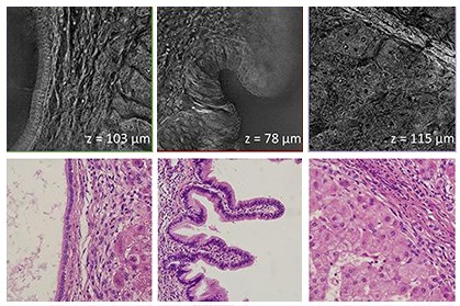 A new holographic histopathology method for improved and fast label-free diagnosis