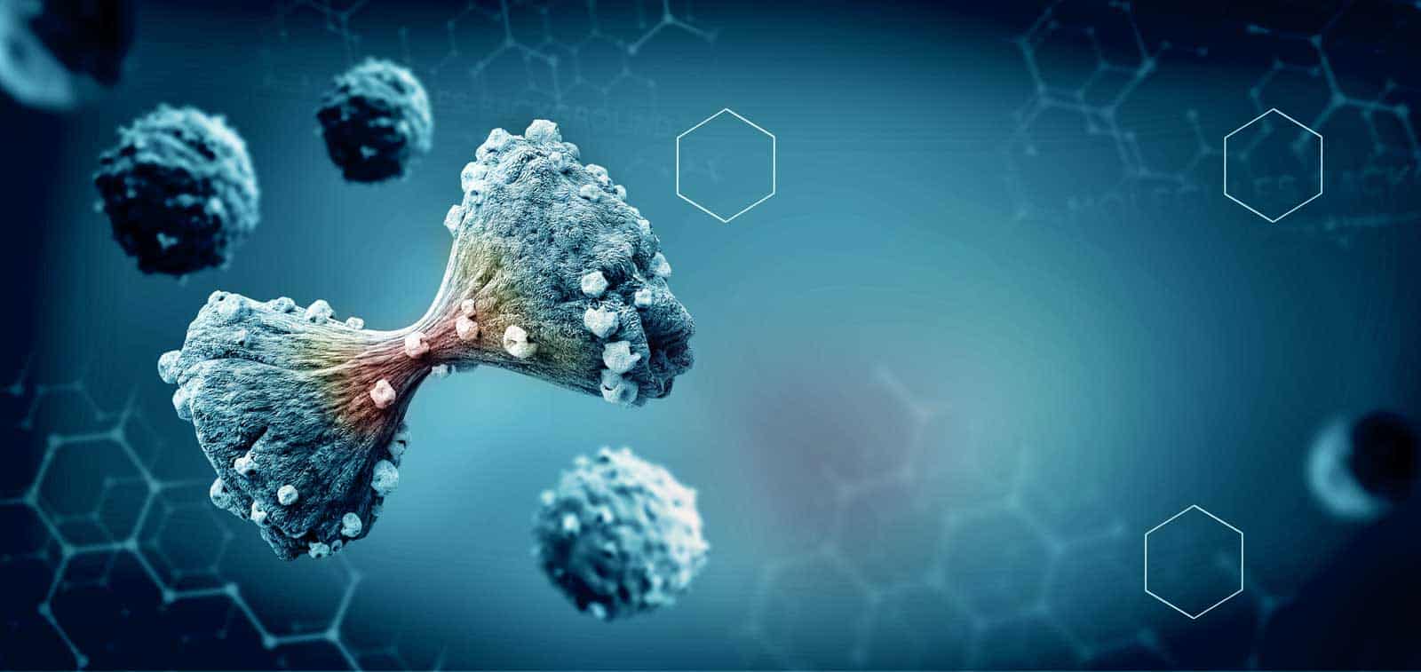  Artificial intelligence system may improve diagnosis of complicated metastatic cancers