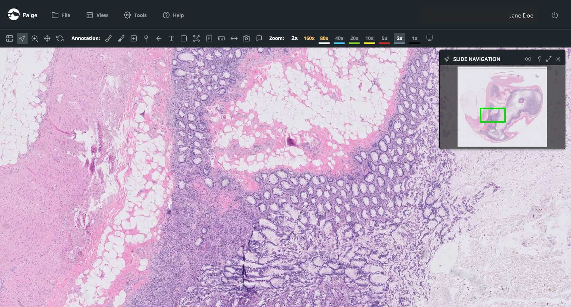 Paige Receives FDA Clearance for the FullFocus™ Viewer for Digital Pathology