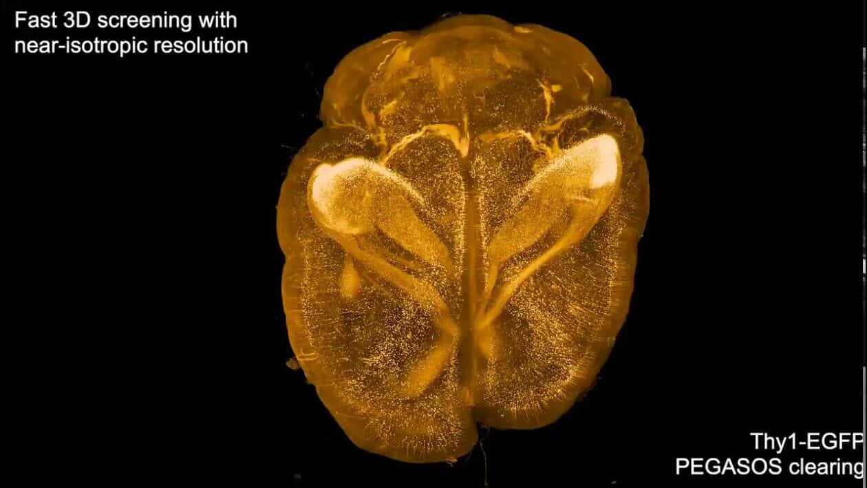 3D brain lightspeed bio microscopy