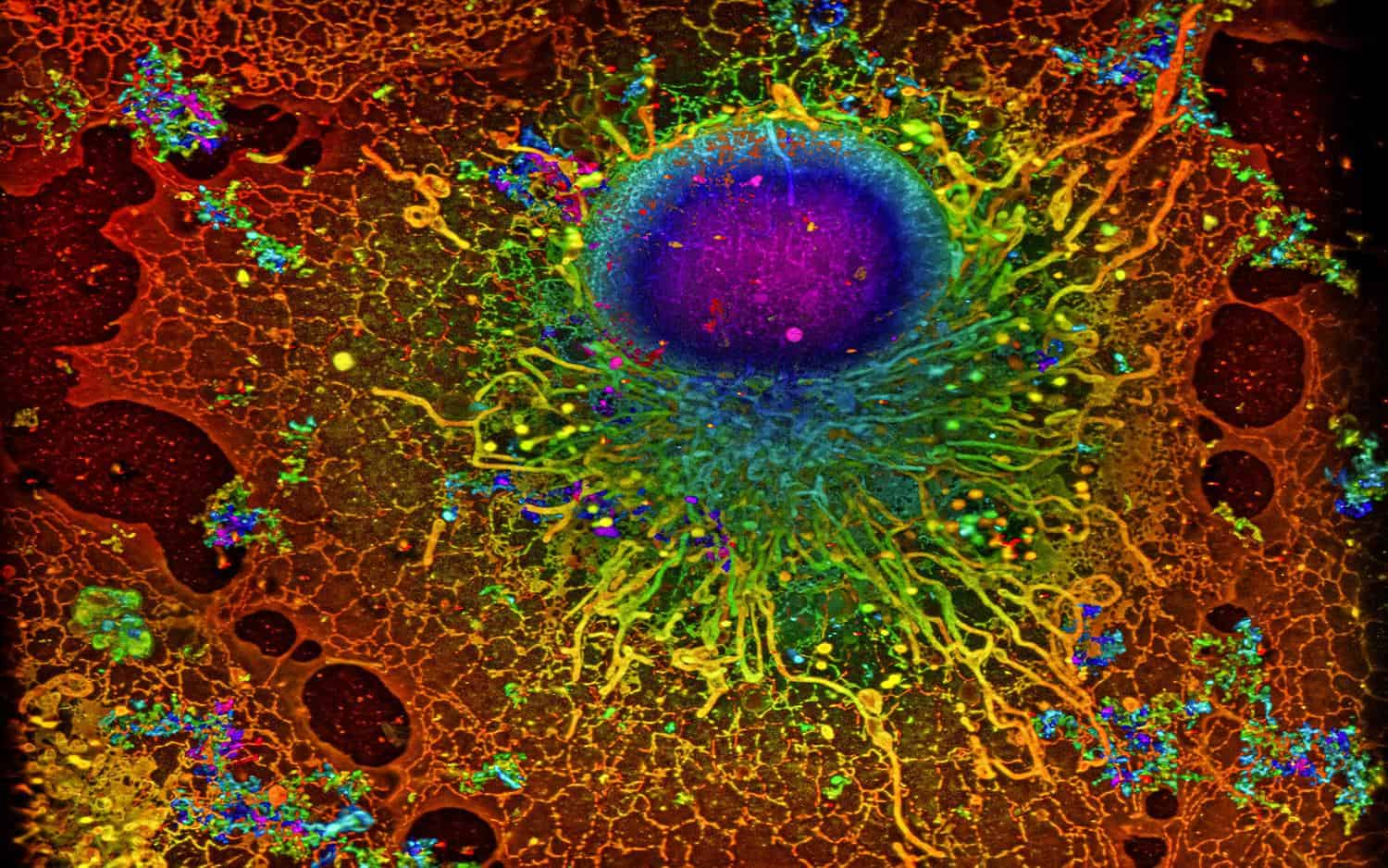 Cell imaged with SMLM