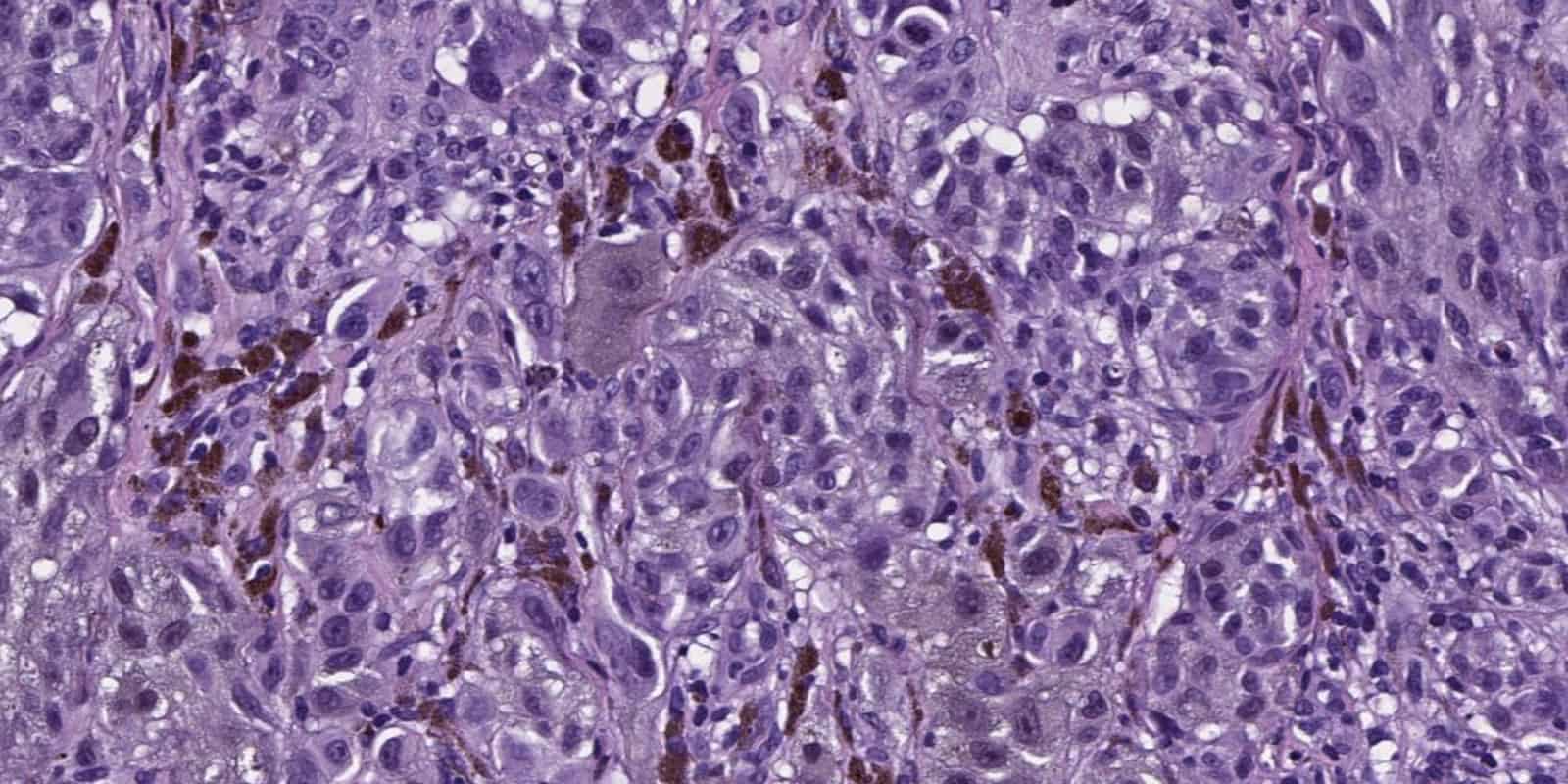 Proscia - Digital Pathology