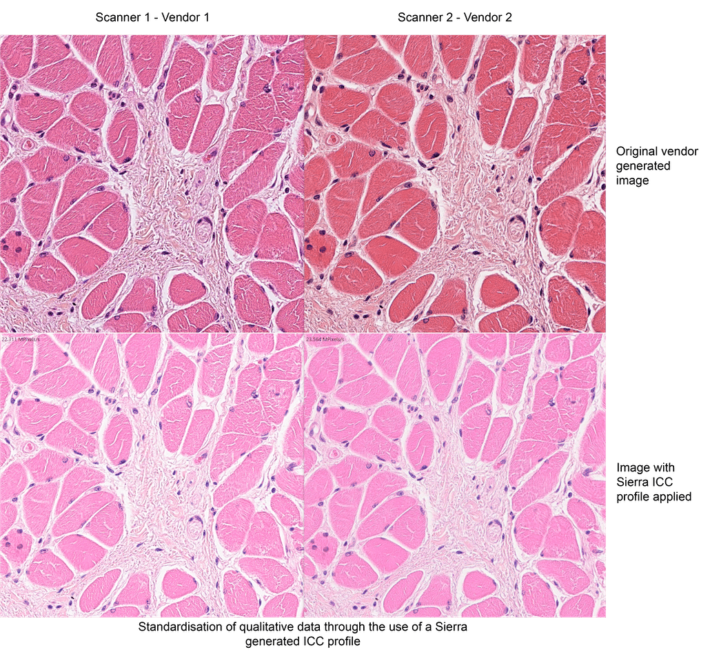 Digital Pathology - Visiopharm