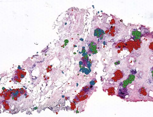 Computational approach enables spatial mapping of single-cell data within tissues