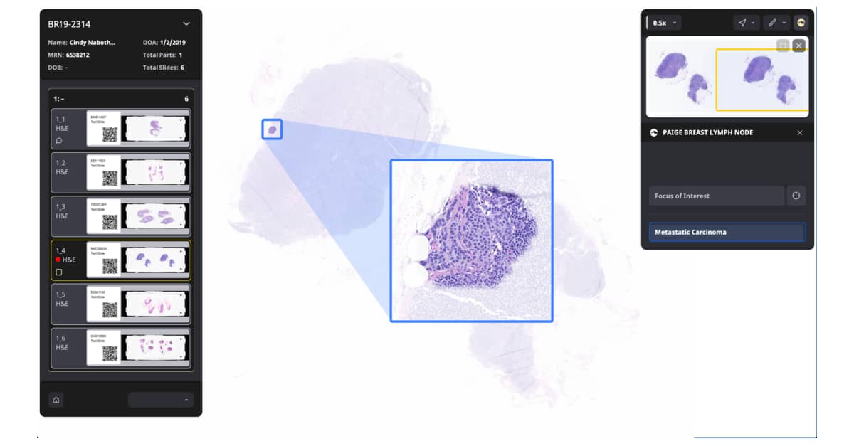 Paige AI breast cancer lymph node screening