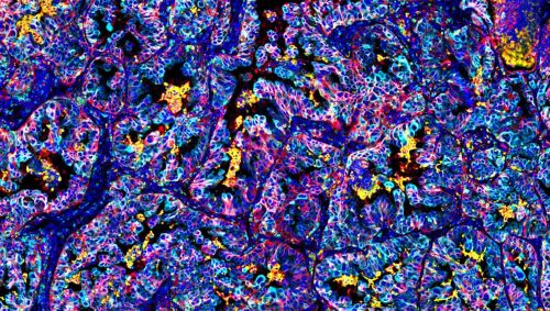 Ultivue - Panels - Digital Pathology