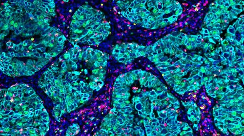 Ultivue - Panels - Digital Pathology