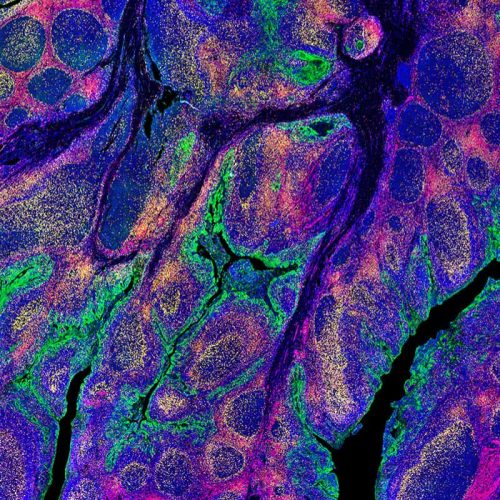 Ultivue - Digital Pathology
