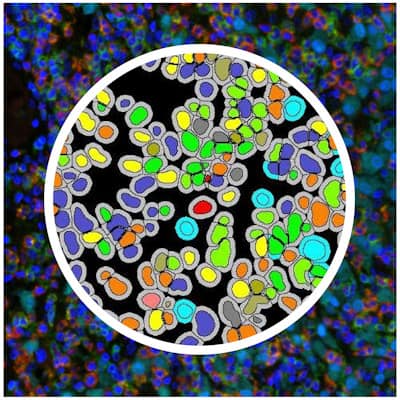 Indica Labs - Digital Pathology