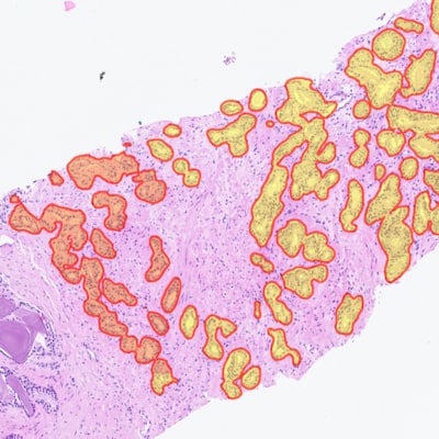 Indica Labs - Digital Pathology
