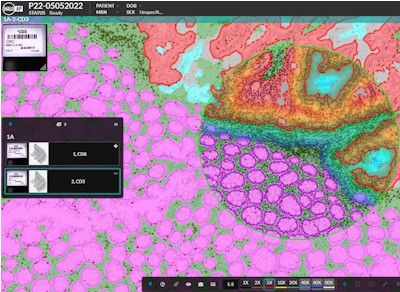 Indica Labs - Digital Pathology