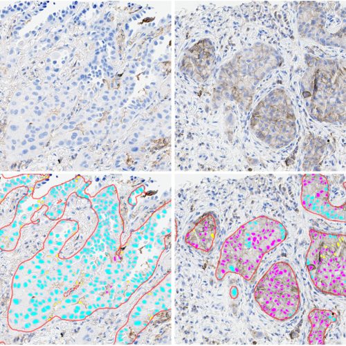 HALO Clinical AI, digital pathology, indica labs