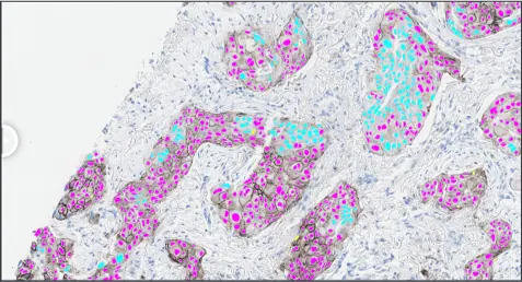 Lung-PD-L1-AI