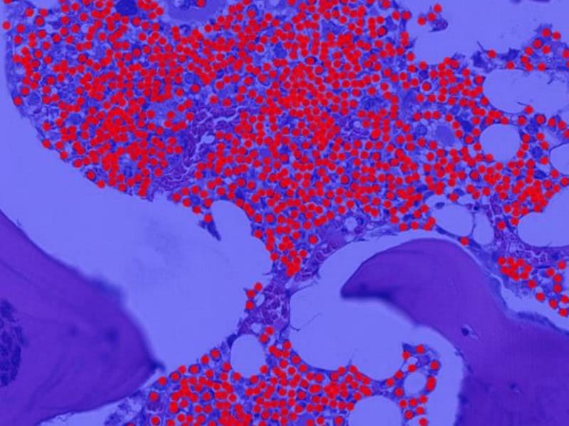 digital pathology, aiforia, pathology news