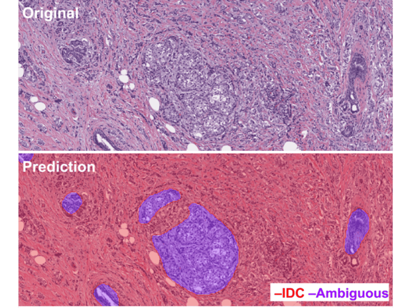 Deep Bio, Digital Pathology