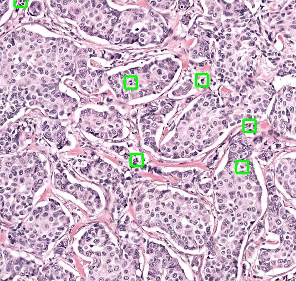 Aiosyn Mitosis Breast