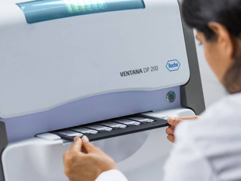 Roche Diagnostics, Ventana, Slide Scanner, Digital pathology