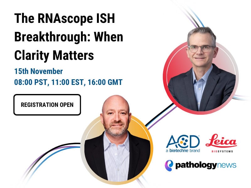 New November 15th Webinar Featured Image