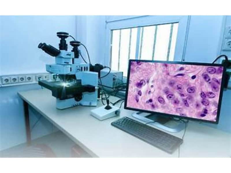 AI, Digital Pathology
