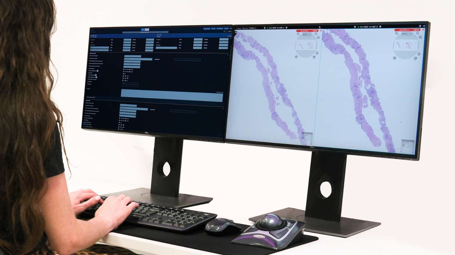 Synapse® Pathology - Image 2