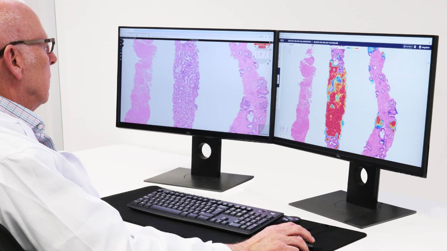 Synapse® Pathology - Image 4