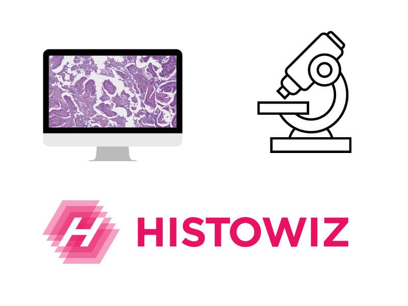 Career, Histowiz