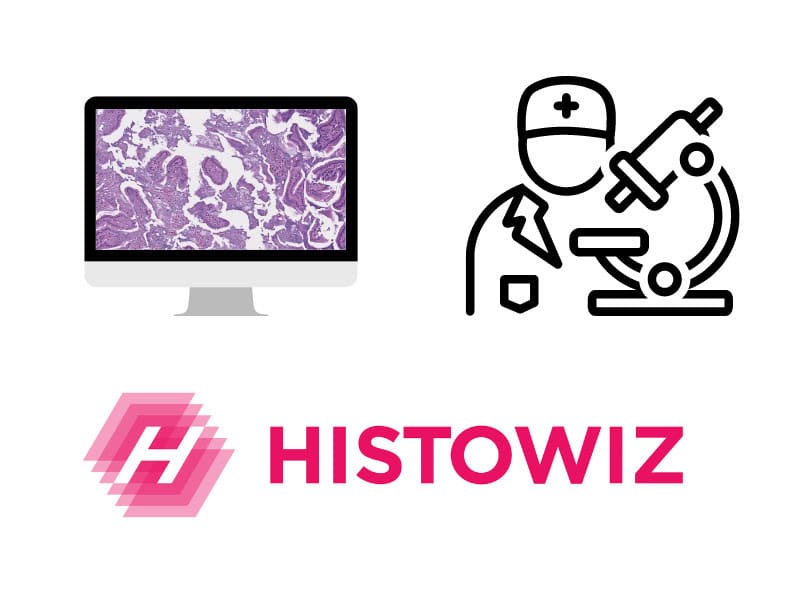 Career, Histowiz