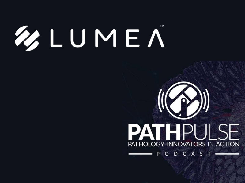 Lumea