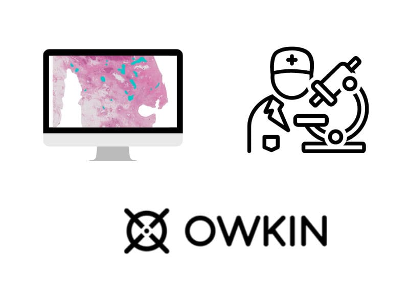 Career, Owkin