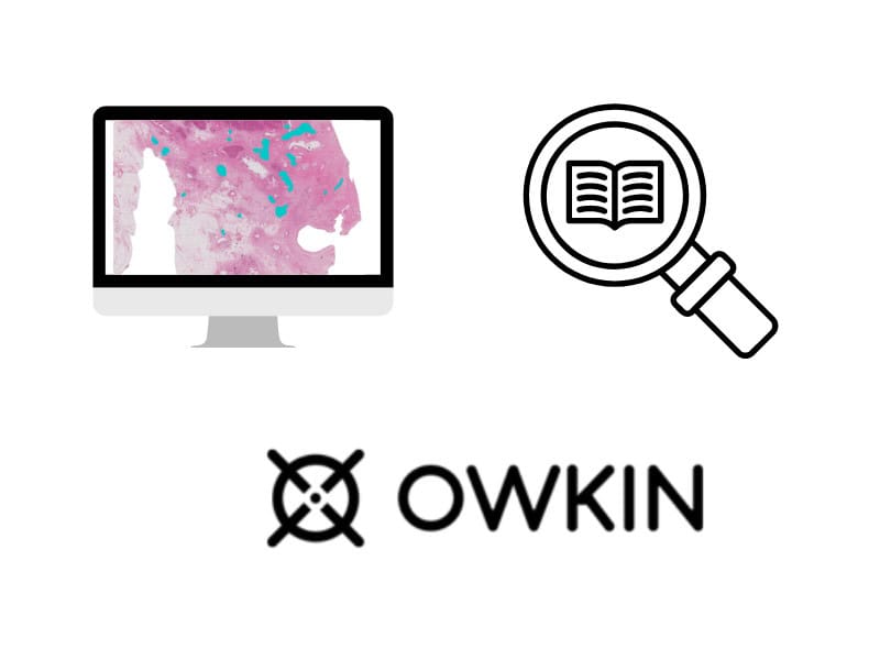 Career, Owkin
