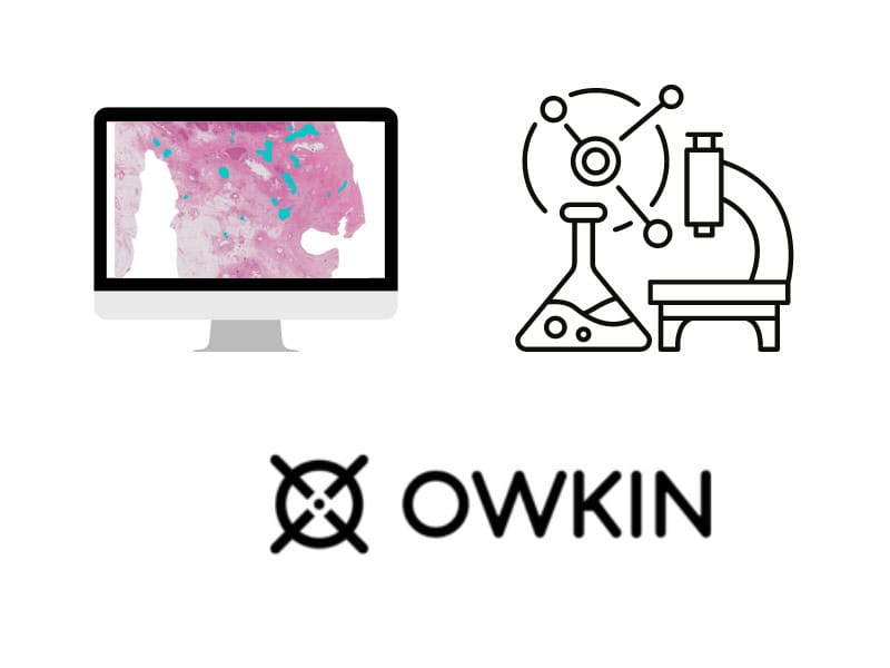 Career, Owkin