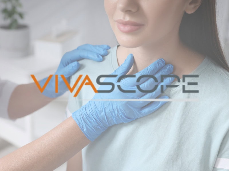 Vivascope