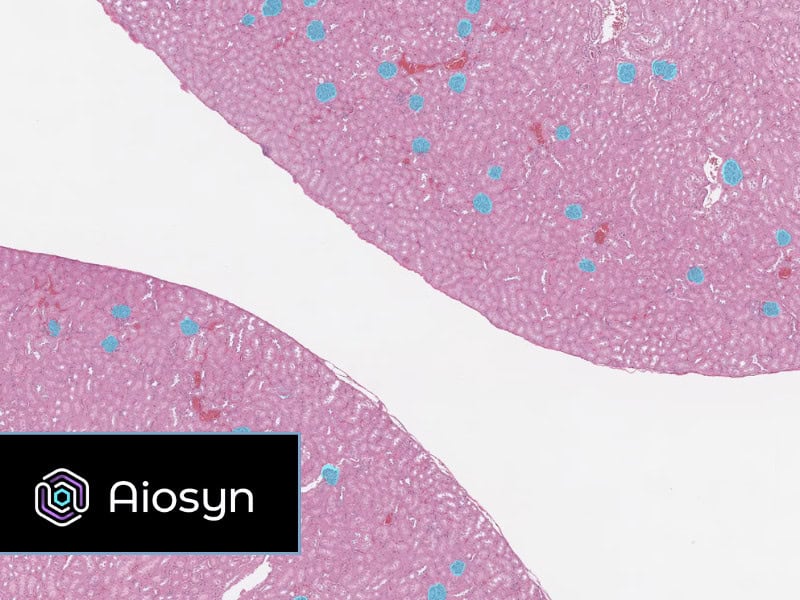 Aiosyn featured