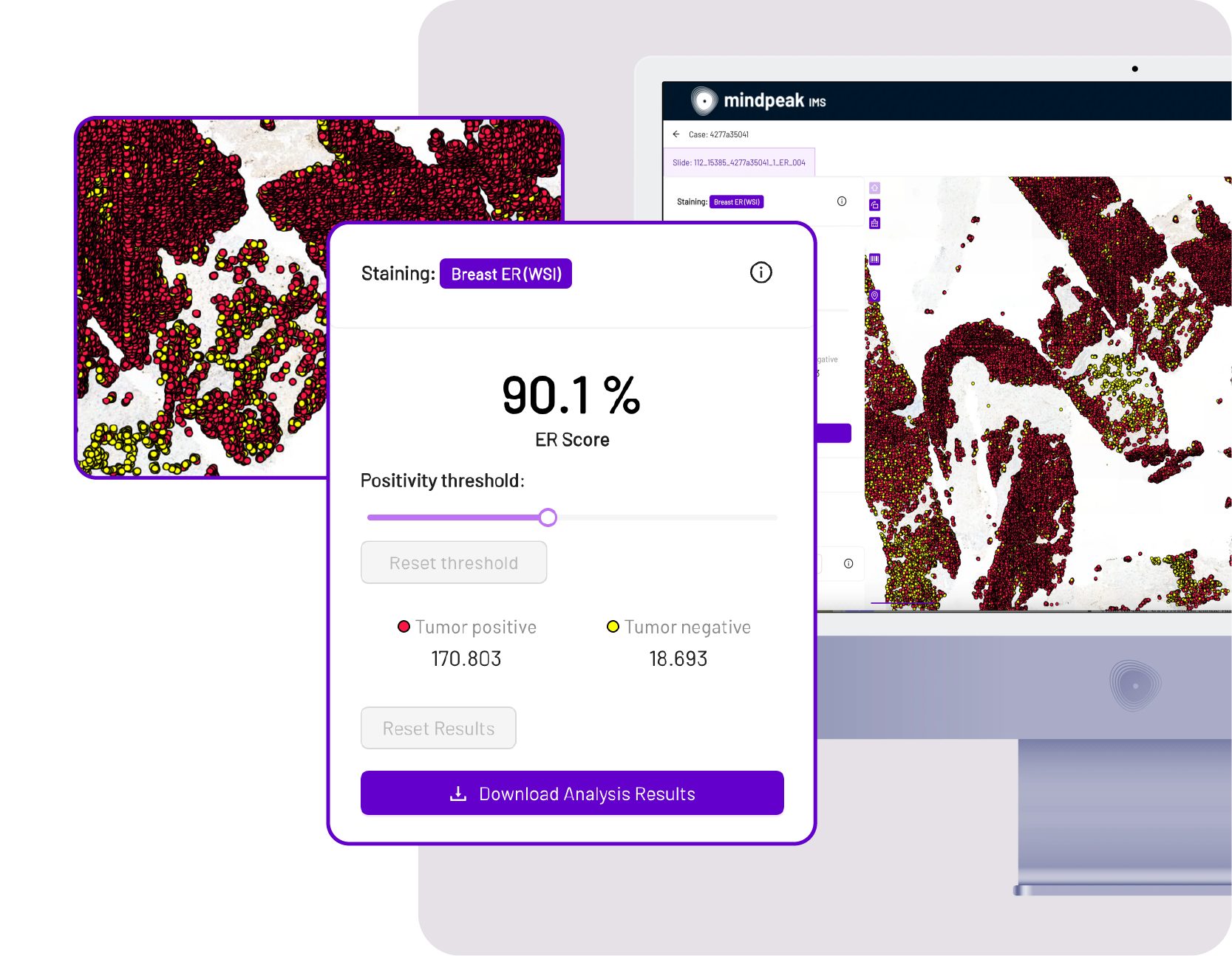 01 mindpeak breast automated whole slide analysis