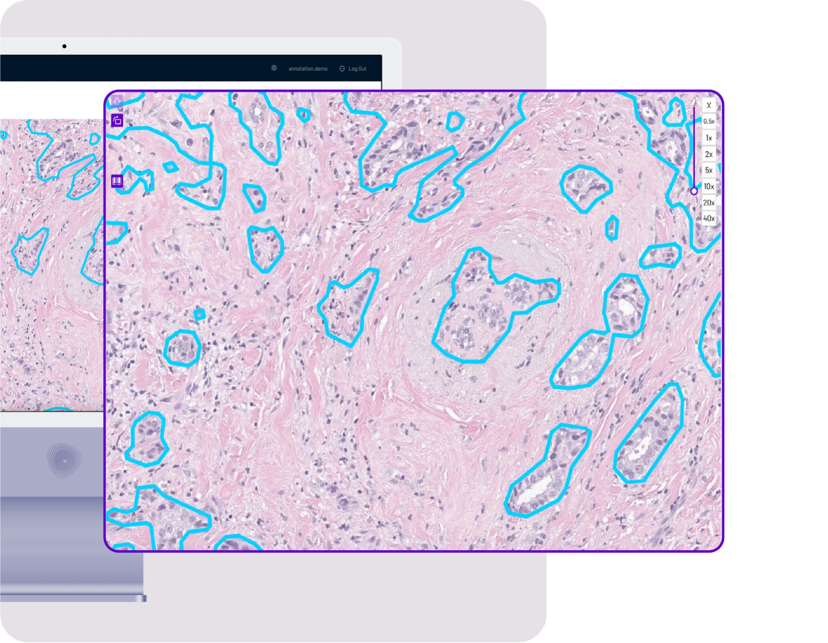 02 mindpeak breast precise tissue segmentation