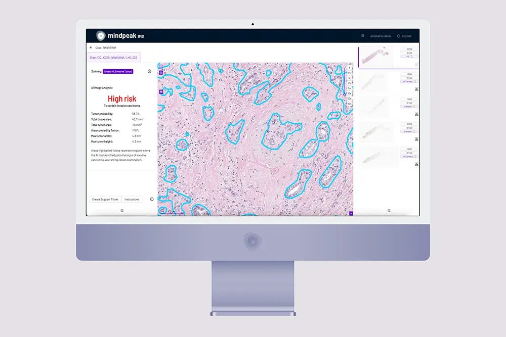 03 mindpeak screen breast he 1000px