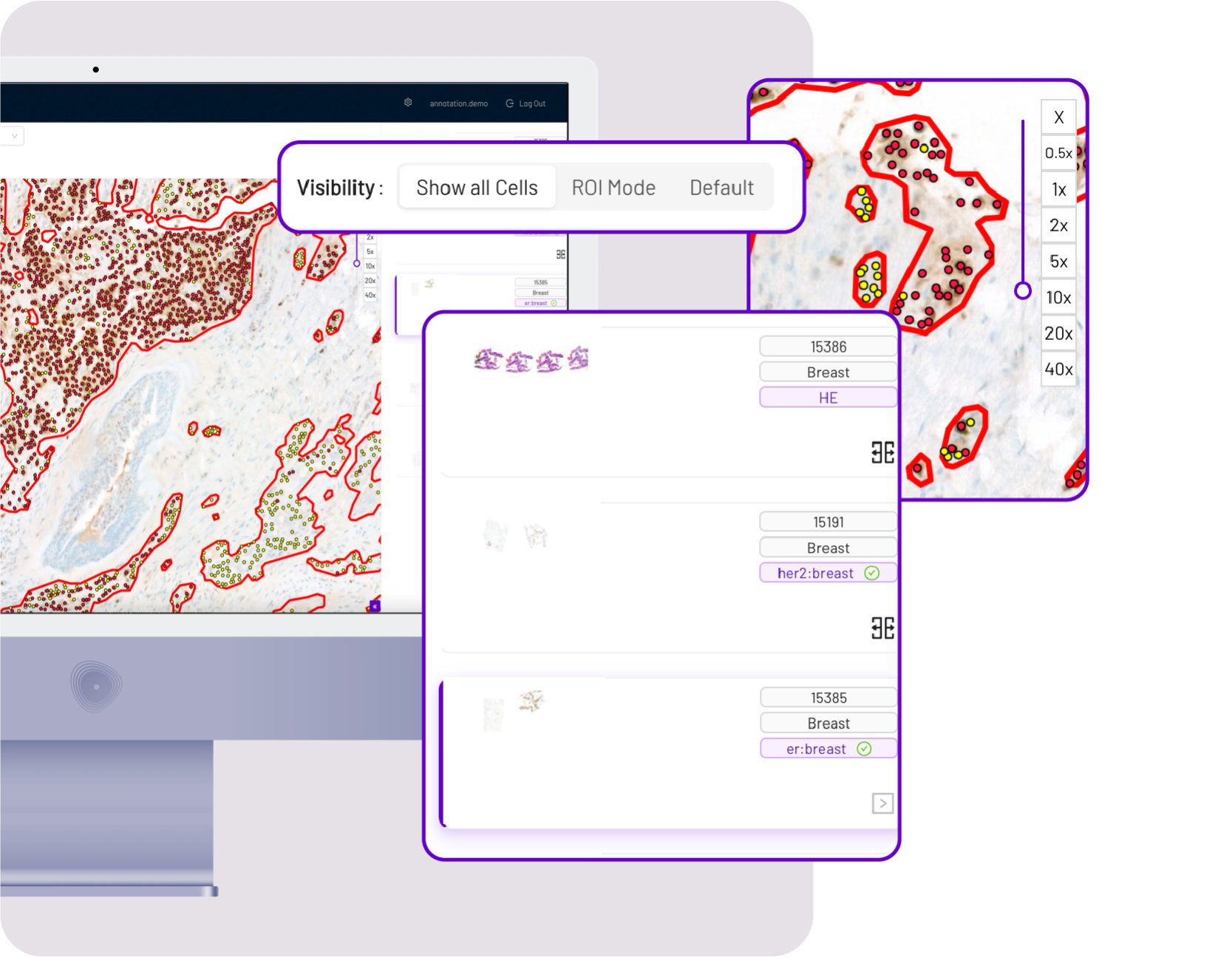 04 mindpeak breast intuitive user interface