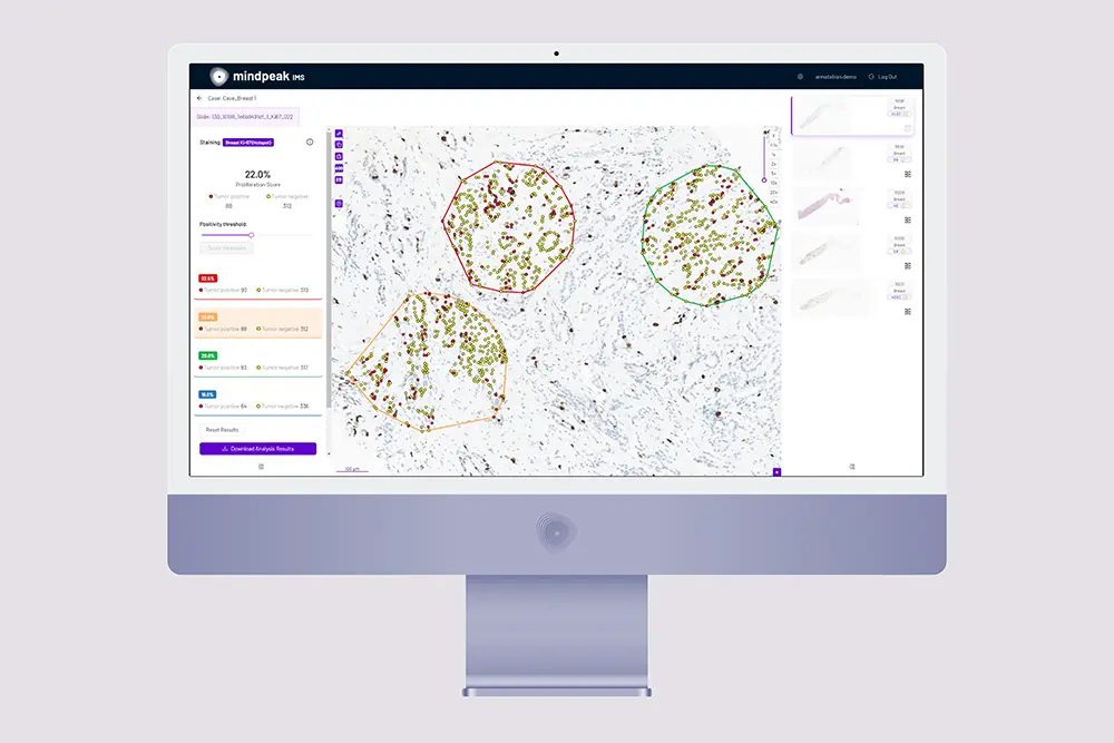 05 mindpeak screen ki67 1000px