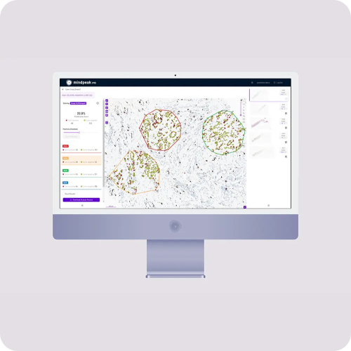 Mindpeak Breast suite