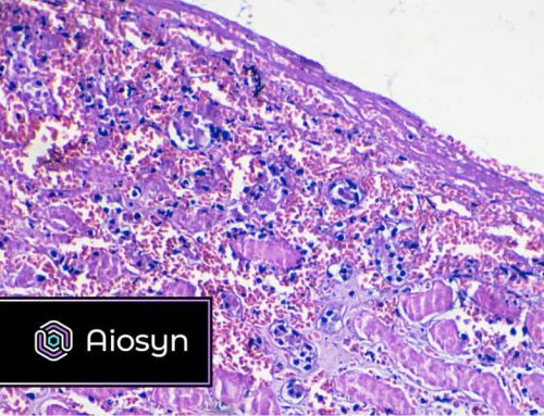 Aiosyn and Pramana Introduce Real-Time AI Processing  for Kidney Biopsy Assessments