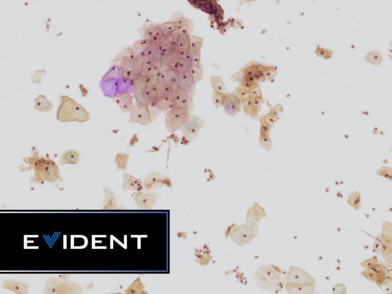 EVIDENT Expands Digital Pathology Applications with Z-Stack Capabilities