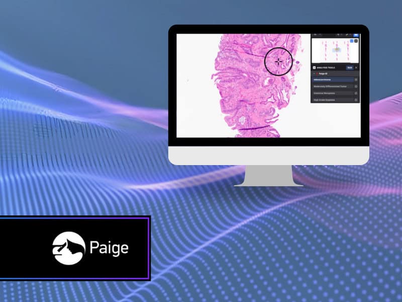 Paige Launches New System-Wide AI Application for the Gastrointestinal Tract (1)