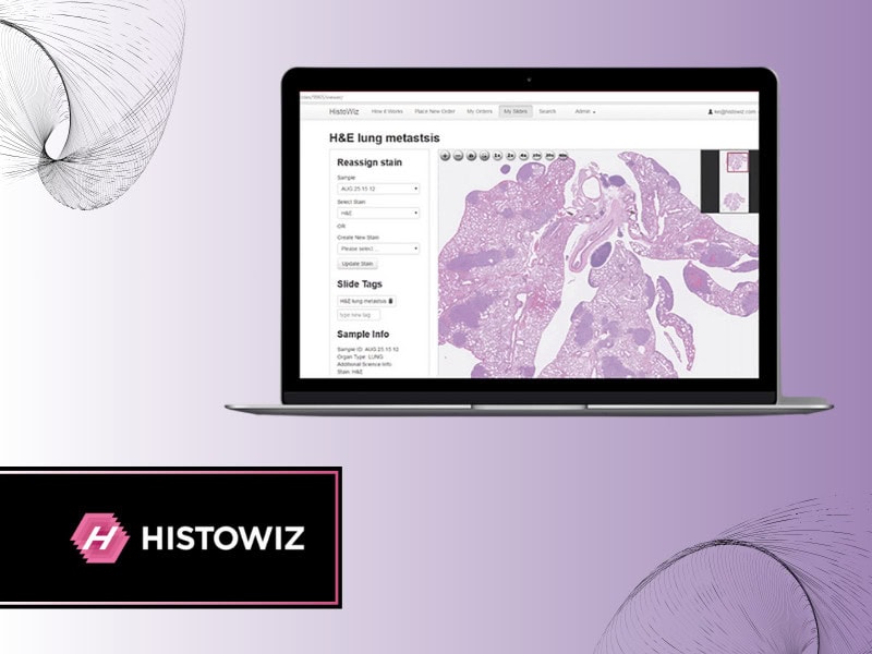 Protege and HistoWiz Partner to Digitize and Unlock Pathology Data for AI Training