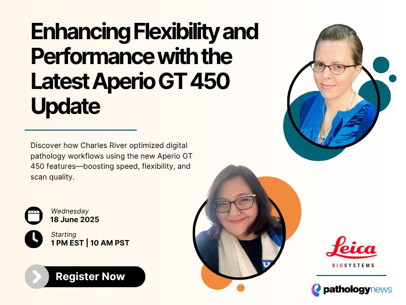 Featured image faster, smarter scanning unlocking the full potential of the aperio gt 450. A featured webinar on Pathology News.