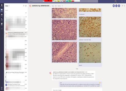 Microsoft teams is great way to share snapshots of a case and dynamically collaborate on a case with a remote expert particularly if you are both part of the nhs.net national network